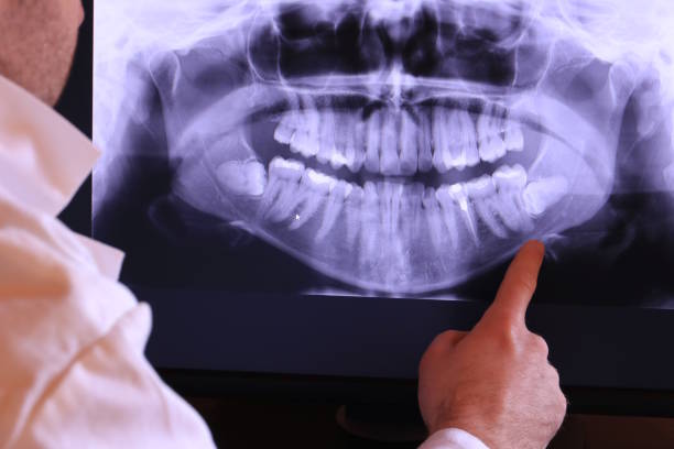 Best Emergency Root Canal Treatment in Ukiah, CA