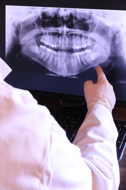 Best Broken or Cracked Tooth Emergency Dentist in Ukiah, CA