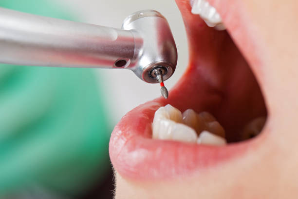 Best Urgent Dental Care for Toothache in Ukiah, CA
